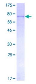 SDS-PAGE (F9-3626H).jpg